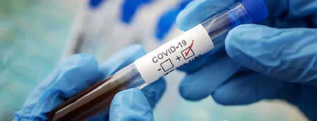 Аутоантитела вызывают длительный и "тяжелый" COVID-19 – исследование