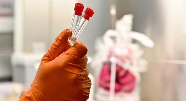 Заболеваемость COVID-19 падает, но смертность растет: медик объяснила причину