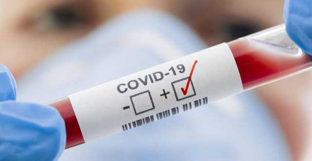 В Украине за сутки от коронавируса умерли более 230 человек