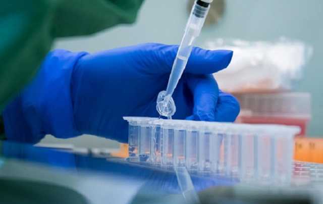 Степанов запевнив, що Україна може робити до 75 тисяч ПЛР-тестів на добу