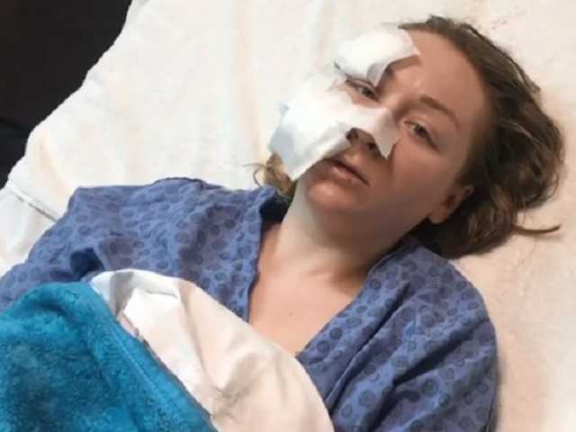 Украинку в турецком ТЦ жестоко искалечил муж