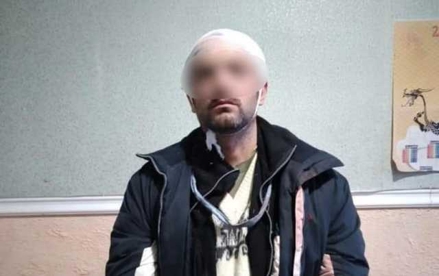 У Первомайську рецидивіст підпалив “Епіцентр”. Йому загрожує довічне ув’язнення