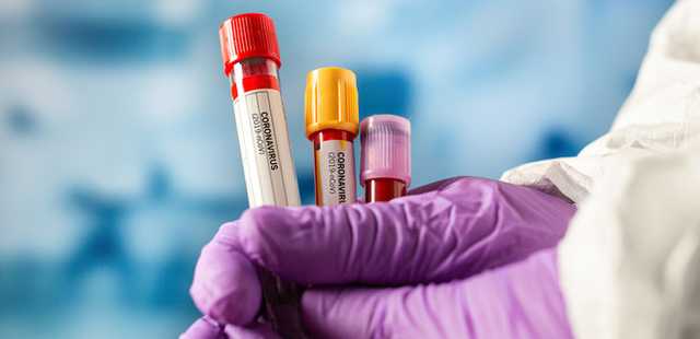 COVID-вакцину сегодня доставят в большинство регионов Украины