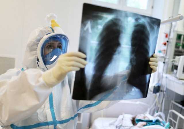 Клиническое течение COVID-19 изменилось: доля молодых возросла, участились обострения, надо ожидать увеличение летальности, - Голубовская