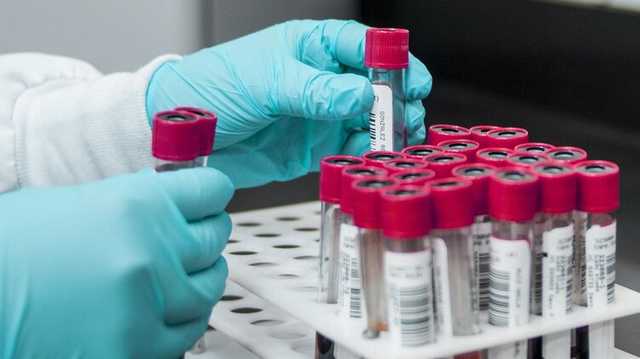 В МОЗ сообщили, сколько украинцев заразились ВИЧ в феврале и каким путем