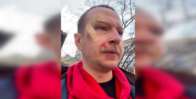 Избиение Майкла Щура в Киеве: ведущий отказался от экспертизы и признал свою неправоту