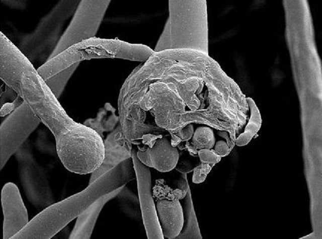 Перший випадок “чорного грибка” виявили в Аргентині