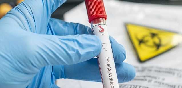 Коронавирусом в Украине заболели почти 600 человек за сутки