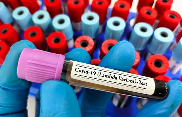 Lambda-вариант COVID-19 – новая угроза?