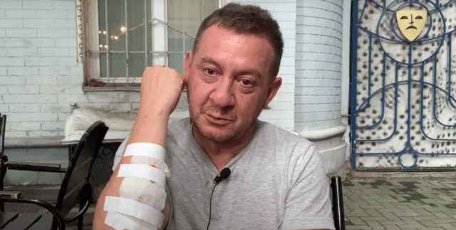 После виски и пива. Выпивший Муждабаев упал и повредил руку в центре Киева