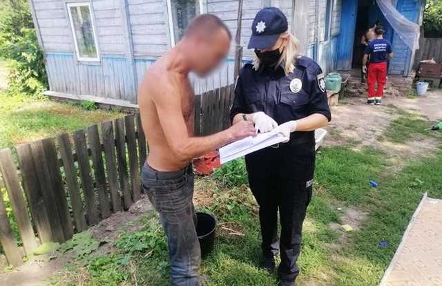 На Чернігівщині чоловік облив бензином та підпалив дружину