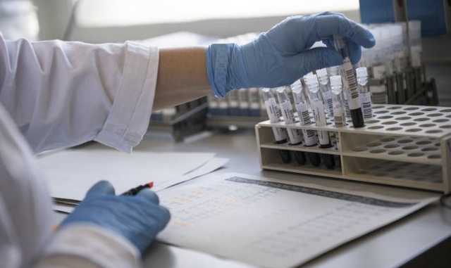 В Ровенской области закончились экспресс-тесты на COVID, поставки ожидаются не ранее октября