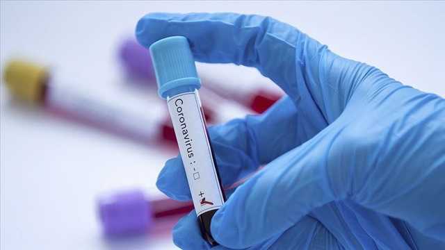 В Украине свыше 15 тыс. новых случаев COVID-19 за сутки, умерли 314 человек