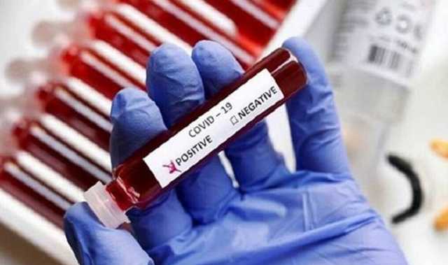 В Украине свыше 23 тыс. новых случаев COVID-19 за сутки, умерли 483 человек