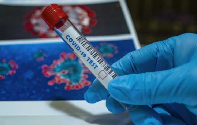 В Украине более 23,5 тыс. новых случаев COVID-19 за сутки, умерли 695 пациентов