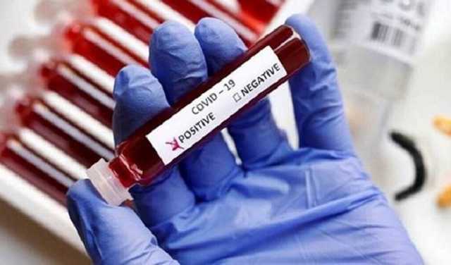 В Украине свыше 16,3 тыс. новых случаев COVID-19 за сутки, умерли 838 человек