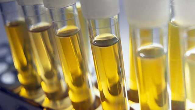 В Минздраве рассказали о вреде уринотерапии