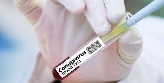 Британия устанавливает рекорды по случаям COVID. Премьер-лига отменяет матчи