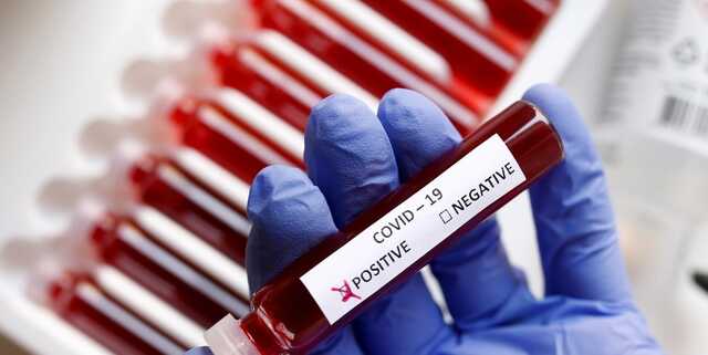 В Украине почти 6 тыс. новых случаев COVID-19, умерли 278 человек