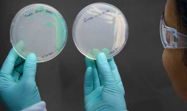 В США зафиксировали вспышку смертельного грибка, который устойчив ко всем препаратам