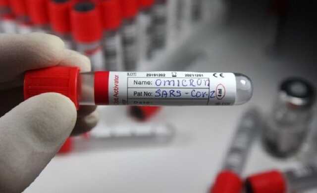 Штам «Омикрон» в Украине: зафиксировали первый случай заболевания в Полтавской области
