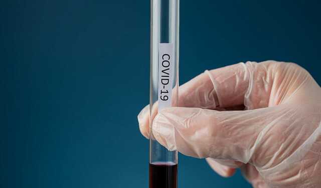 В Японии начали тестирование нового препарата против штамма "Омикрон"