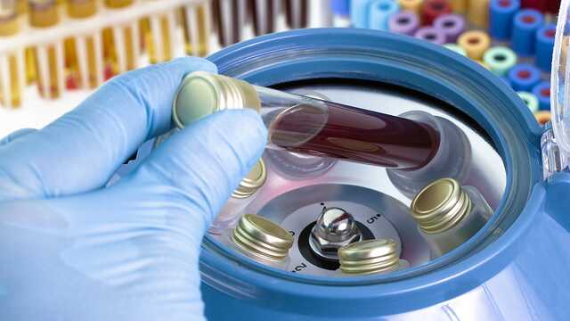 В Европе новый штамм ВИЧ