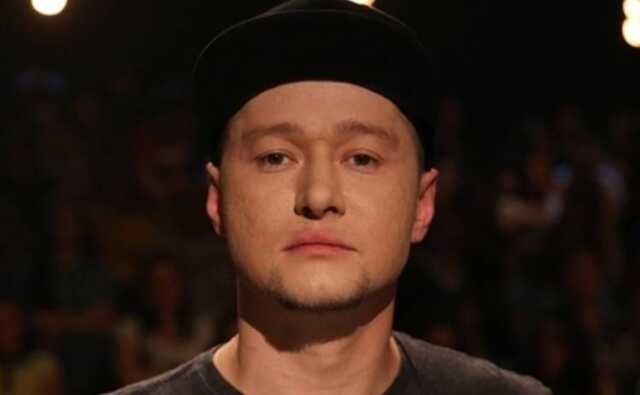 Фронтмен Бумбокса, показал, как выглядит после осколочного ранения в лицо