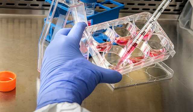 Оспа обезьян будет в Украине: ждать ли вспышку