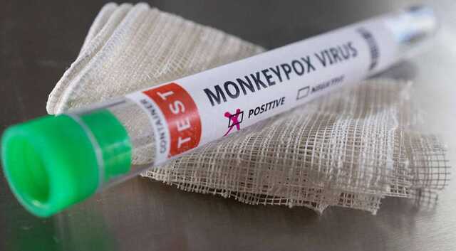 Первый случай обезьяньей оспы подтвердили в Польше