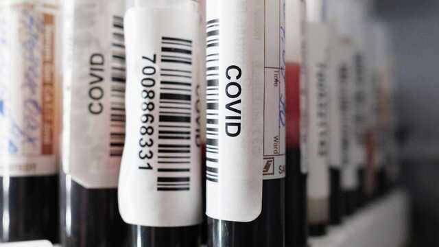 У Росії звинуватили США в причетності до появи COVID-19 і навіть назвали "вигодонабувачів"