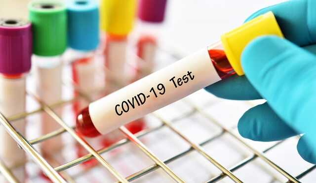 Коли в Україні буде осінній пік захворюваності COVID-19: відповідь ВООЗ