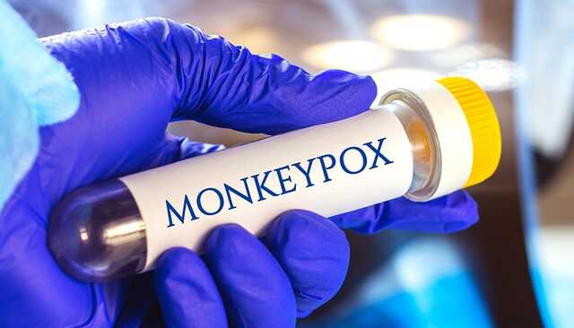 Головний санлікар розповів, чи загрожує Україні епідемія мавпячої віспи