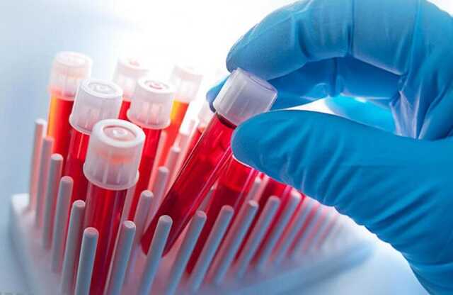 Оккупанты выдаивают из коллаборантов кровь для своих подранков