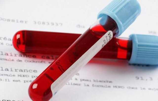 Активатор згортання крові для бійців ЗСУ розробили науковці у Львові