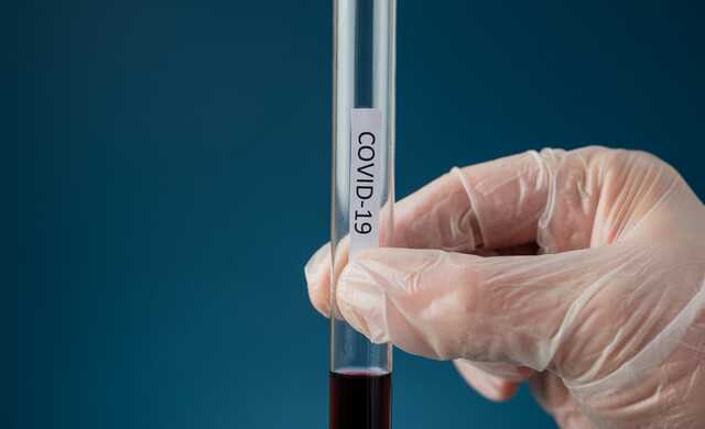 Специфічних симптомів немає: в МОЗ розповіли про особливості нового підвиду COVID-19 "Кракен"