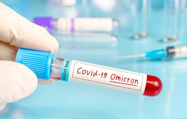 Україною розповзається новий і дуже заразний варіант коронавірусу Омікрон