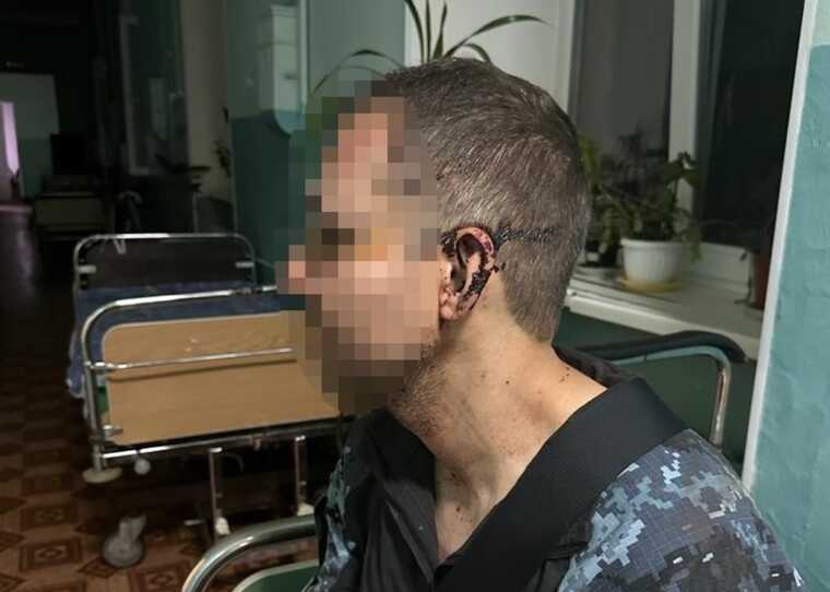 На Одещині в одній із військових частин побили військового, - ДБР