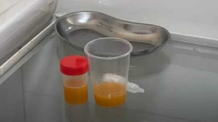 У Львові водій під наркотиками здав на аналіз сік замість сечі