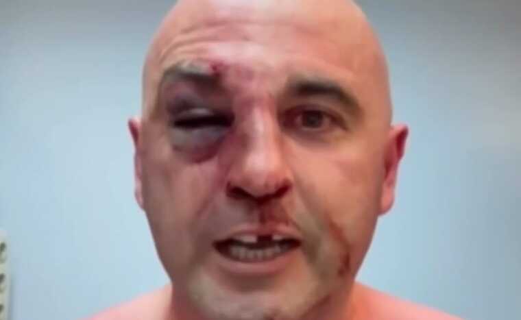 Силовики в Тбилиси жестоко избили лидера оппозиционной партии Левана Хабеишвили