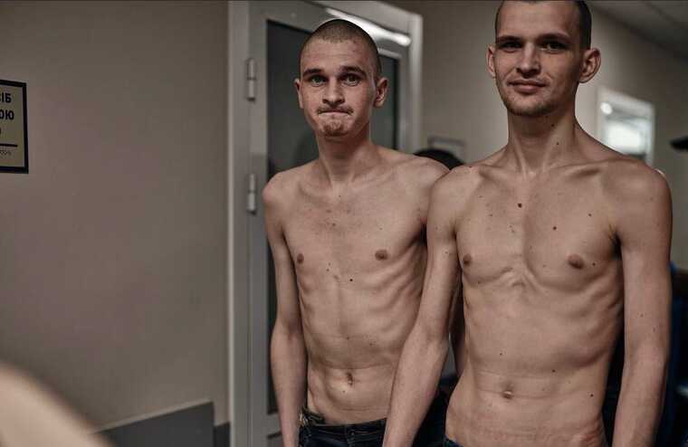 У мережі показали, в якому стані повернулися додому звільнені з російського полону