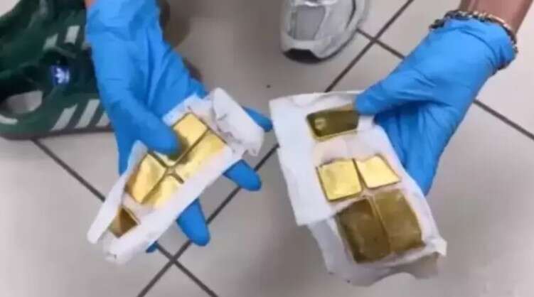 У Туреччині було затримано жінок, які намагалися провезти понад 9 кг золота в геніталіях