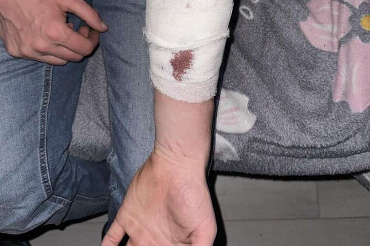 In the Odesa TRC, a young man slit his wrists, - social media