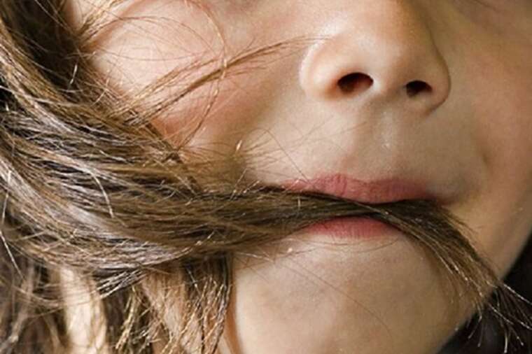 У Львові медики видалили зі шлунку підлітка волосся: у дівчинки діагностували "синдром Рапунцель"