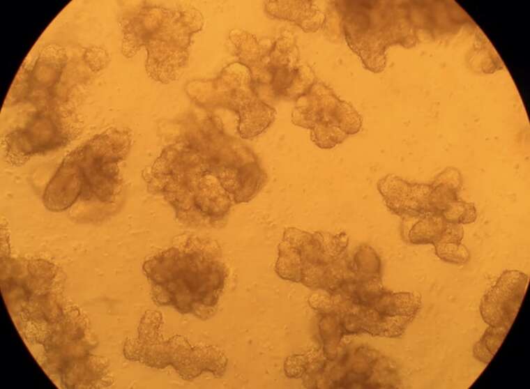 У Фінляндії створили новаторський метод для діагностики раку