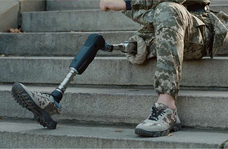 Военнослужащего с ампутированной ногой признали годным к службе, - соцсети