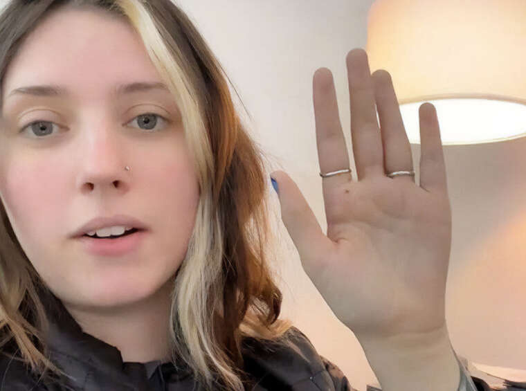 ChatGPT врятував дівчину від раку - вона попросила його "поворожити по руці"