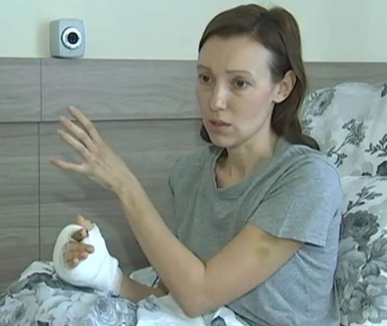 У Києві пересадили пацієнтці вказівний палець зі стопи на руку