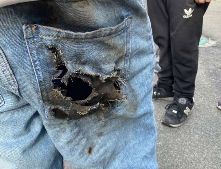 На Київщині 13-річний підліток отримав опіки через вибухову деталь, імовірно, від «шахеда»