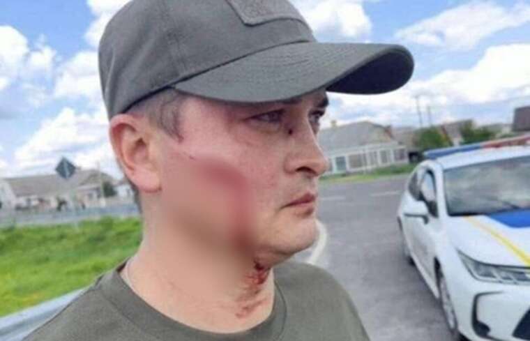 The employee of the TRC who was hit with a shovel demands 50 thousand hryvnias in compensation
